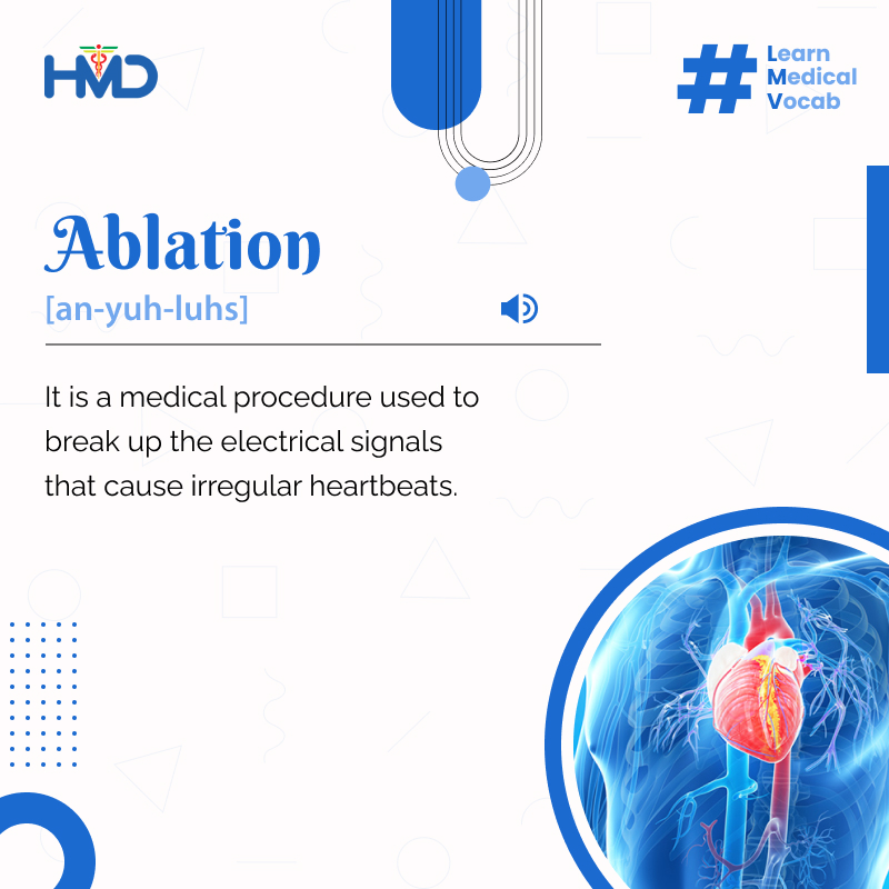 hmdhealthcare's tweet photo. Ablation therapy is a procedure used to treat #arrhythmia. It is also used instead of #opensurgery to preserve #healthytissue & reduce #surgicalrisks. #Ablationtherapy has several benefits, including a shorter hospital stay & a #quickerrecovery
#MedicalProcedure #MedicalGlossary https://t.co/O3i9VKlHMQ
