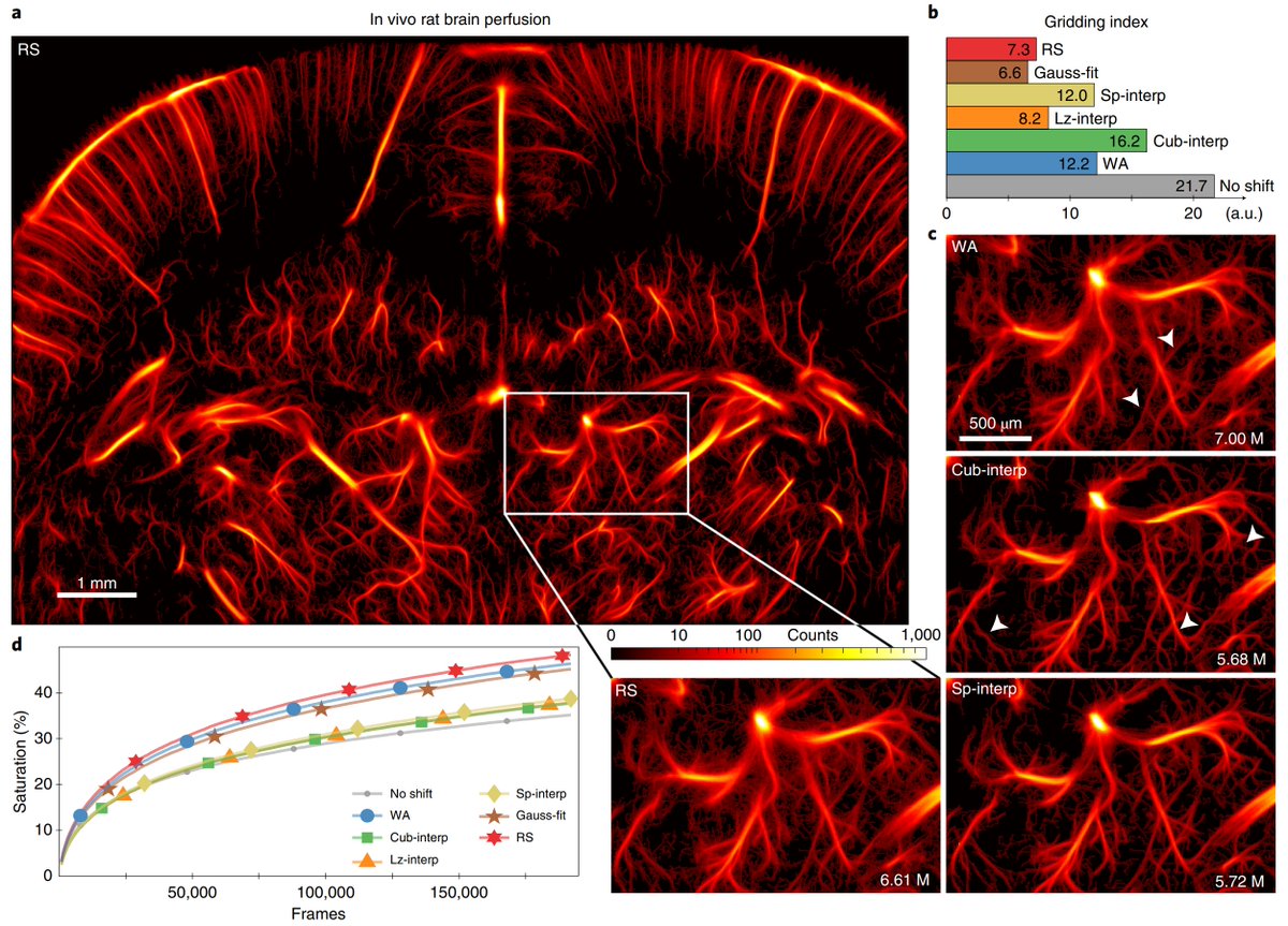 bgheiles's tweet photo. 🚨 New paper alert🚨
Very happy to share our new paper "Performance benchmarking of microbubble-localization algorithms for ultrasound localization microscopy" published in @natBME w/ A. Chavignon, @VincentHingot, P. Lopez, E. Teston and O. Couture https://t.co/PqOie5xfcW https://t.co/Iguh9CkcaK