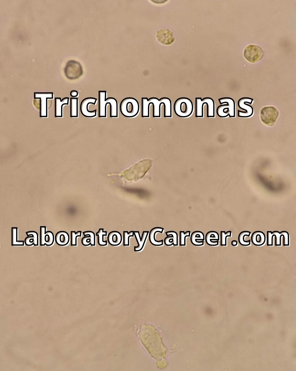 lab_career's tweet photo. WET MOUNT testing under the scope is used to diagnose trichomonasis or vaginitis. Here’s a quick video of a CLS doing just that https://t.co/fJLt1I9UqX #microbiology #laboratorycareer #lablife #sciencerocks #microscope #sciencemajor #biology #clinicallaboratoryscience https://t.co/5mdytsJr5t