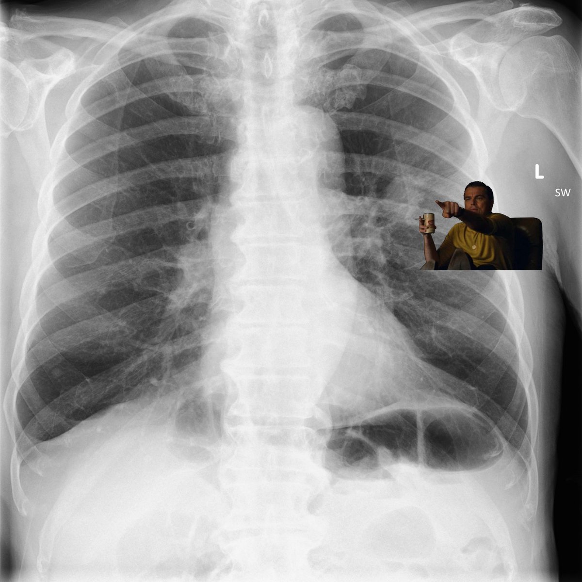 DrLongissimus's tweet photo. Sending the PACS guy my new arrow design ideas because the current one is too basic let's see what he says https://t.co/PjkqfQYMWf