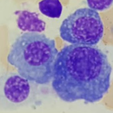 mer_501's tweet photo. Urgencias hematológicas en un paciente con Mieloma Múltiple?
La Dra. De Soto nos explicará cómo resolverlas 2º edición de #HematoBites Jornadas de urgencias hematológicas para residentes (y adjuntos!) @HematoLaPaz
24/2 16 hs
Link de acceso:
https://t.co/g1rx7rvpG3 https://t.co/fXtGygwbKq