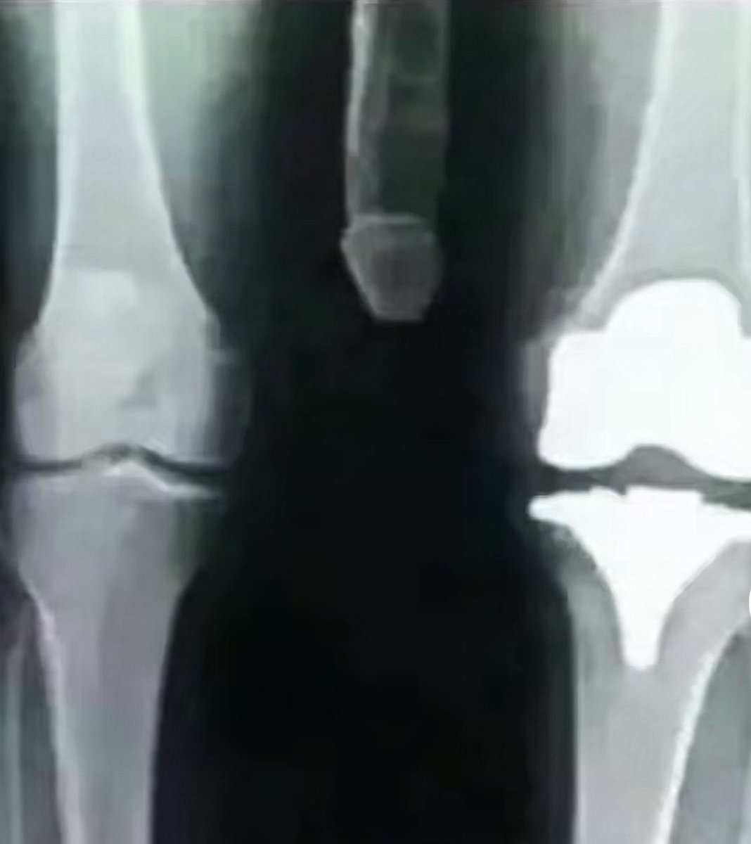 3333Boost's tweet image. Just broke my knee 😑🥺