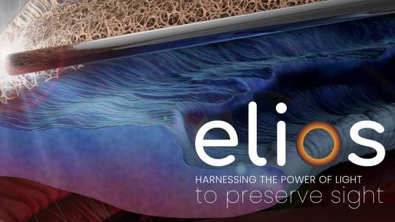 GlaucomaToday's tweet photo. Elios Vision announced 8-year follow up results of its Elios Excimer Laser Trabeculostomy procedure combined with cataract surgery. https://t.co/L6xoaFkmG3 https://t.co/g1fUTwZmBq