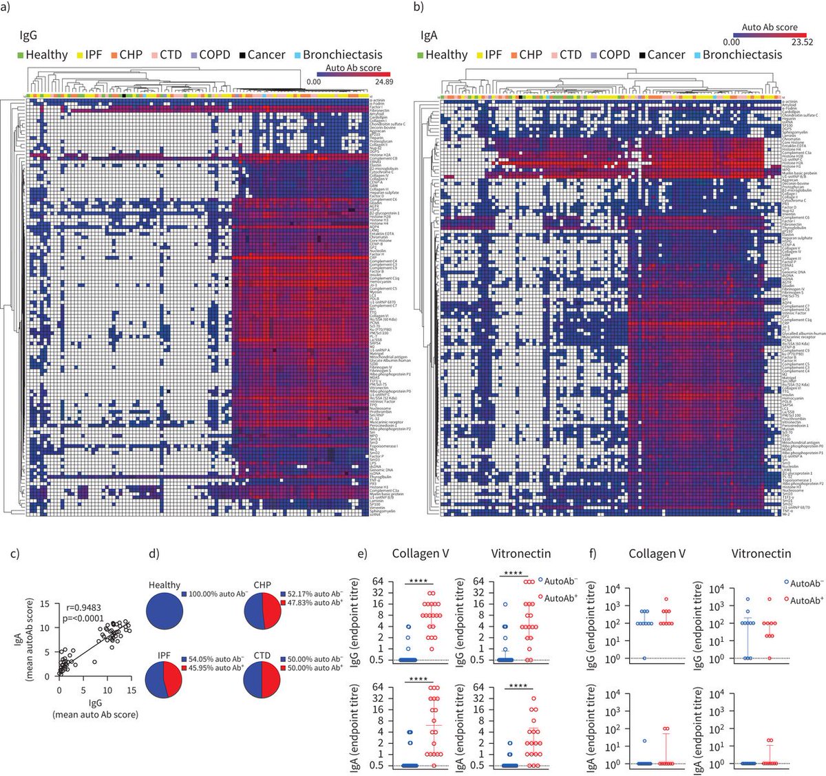 Autoantibodies are present in the bronchoalveolar lavage but not circulation in patients with fibrotic interstitial lung disease bit.ly/3CNvKjj