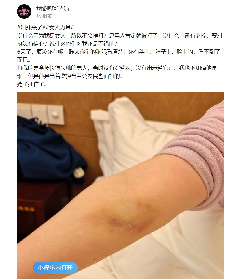 去丰县声援后，被拘留的两个女孩，放出来了。这是后续