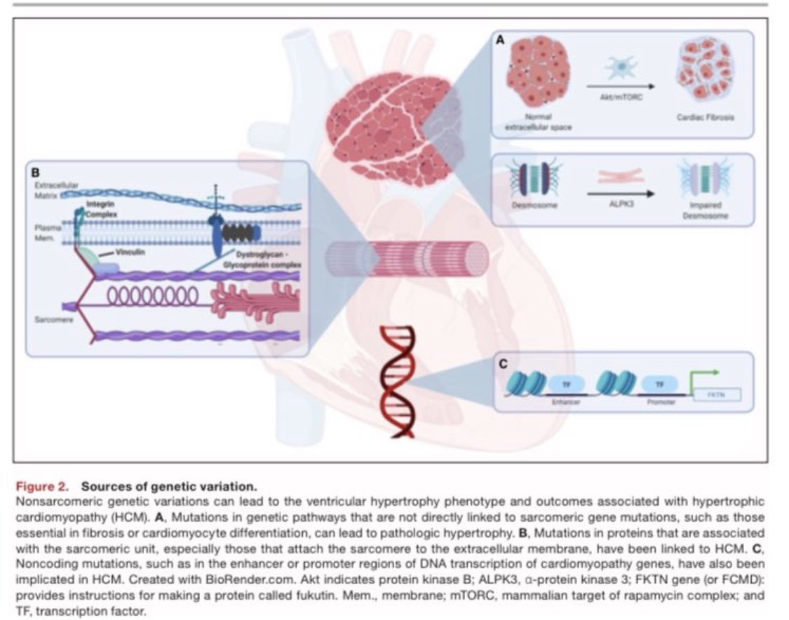 🫀🧬Pediatric Hypertrophic Cardiomyopathy: Exploring the Genotype‐Phenotype Association ahajournals.org/doi/10.1161/JA…