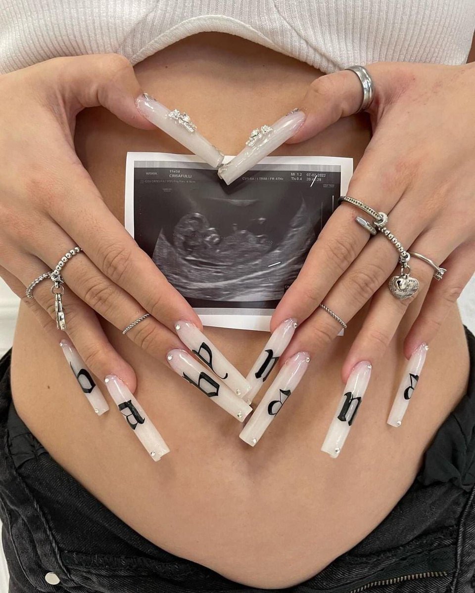 «Me di cuenta de que el aborto no era para mí», Sofía Crisafulli, Tiktoker italiana con 1,3 millones de seguidores. Con apenas 18 años dio una lección al mundo al ir contracorriente. Ella le dijo sí a la vida.