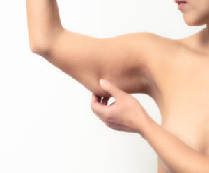 LoVermeBoston's tweet photo. Loose skin on the upper arms occurs for two main reasons- natural aging, and rapid weight loss. Unfortunately, dieting and exercise can’t change our skin’s laxity. #armlift #brachioplasty https://t.co/cAX13nHT32 https://t.co/y7NIFrjo2E