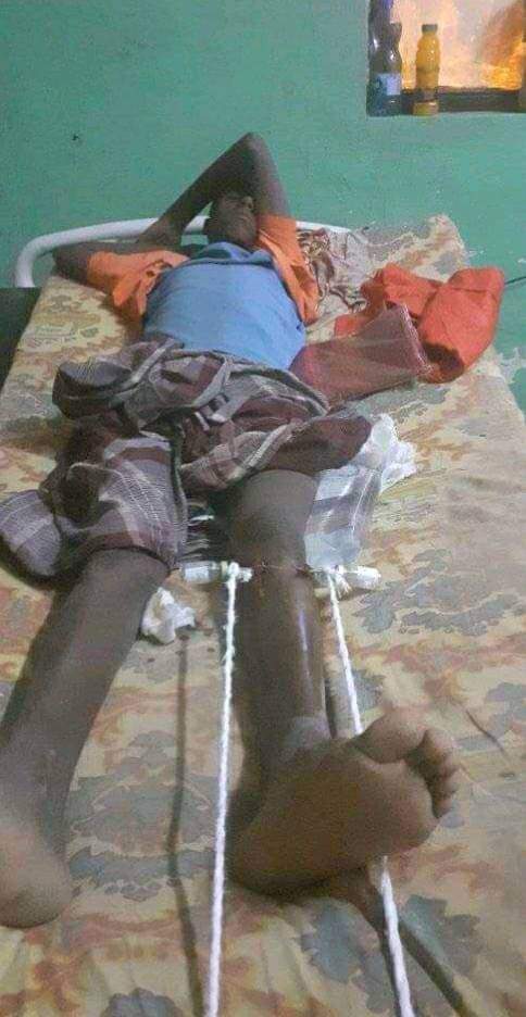MikiShekspir's tweet photo. It is perpelexing to see those who always fulminating against hostilities on civilians is now in defeaning silence as TPLF is wrecking a havoc on Afar people, killing and displacing women and children. Sad!
#AfarUnderAttack https://t.co/wxyijf7x7x