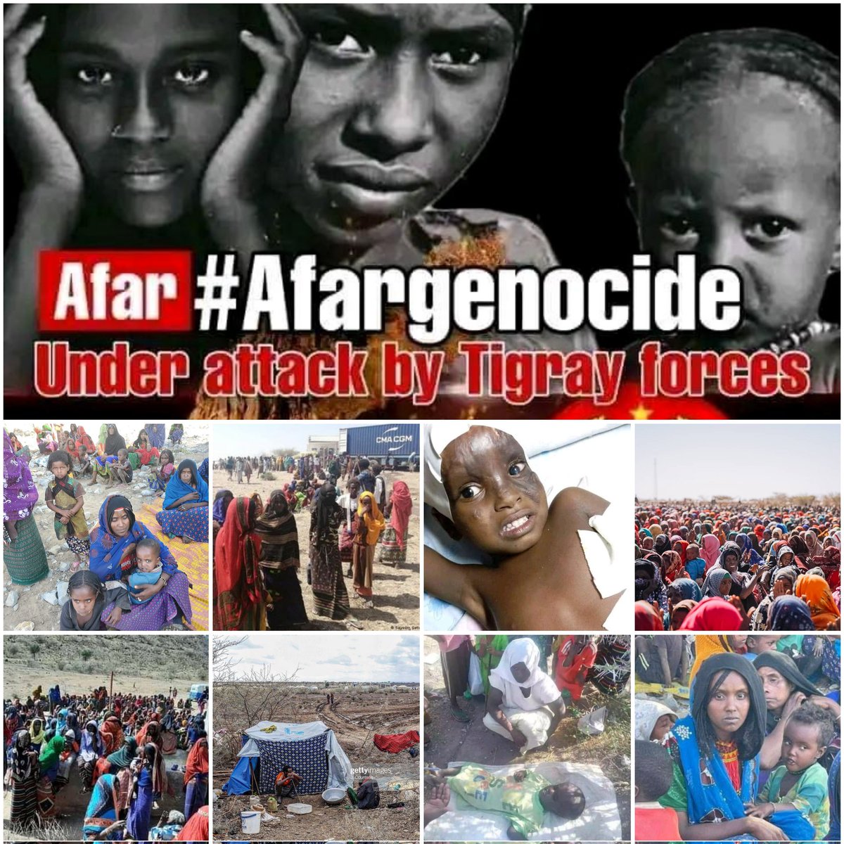MikiShekspir's tweet photo. Children injured &amp; disabled by the TPLF terrorists in #Afar. The brutal massacre must be condemned by the IC. Those orgn who call themselves human right orgn should denounce it,as well humanitarian assistance must deliver ASAP. #AfarKidsUnderAttack #AfarUnderAttack #AfarGenocide https://t.co/pvKBlM4kgc