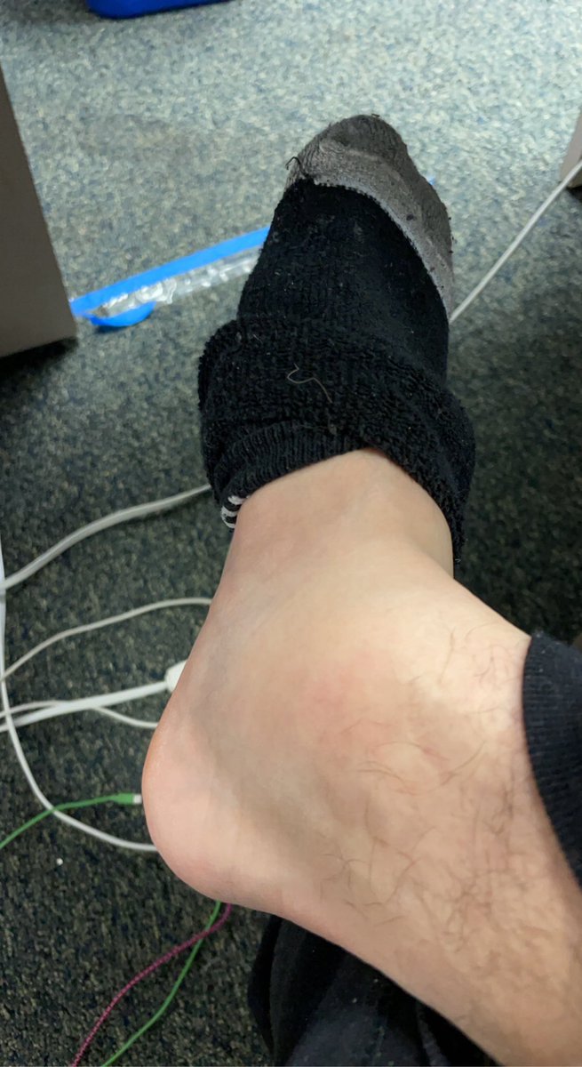 JayRugenus's tweet photo. Am I really playing soccer if I don’t get an ankle injury? https://t.co/dUrrYfQnal
