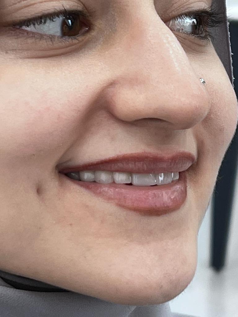 Cedent_'s tweet photo. Bu gün bitirdik👍 Genç hastamız çok mutlu oldu, https://t.co/E9l52K1rbw