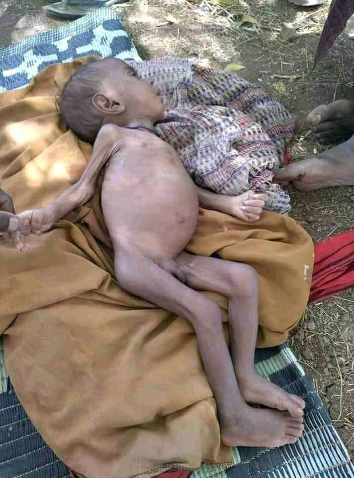 Mohammedkadir09's tweet photo. This kids aren't from Tigray, They are from #Afar. It may not stir world opinion, just because it is not from an area famous for its historical churches.
The unprovoked #TPLFAttack against #Afar innocents must be stopped now! #AfarUnderAttack @rt_ https://t.co/7EaZFeXTuz