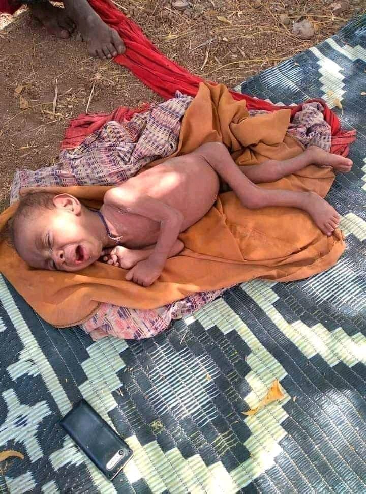 Mohammedkadir09's tweet photo. This kids aren't from Tigray, They are from #Afar. It may not stir world opinion, just because it is not from an area famous for its historical churches.
The unprovoked #TPLFAttack against #Afar innocents must be stopped now! #AfarUnderAttack @rt_ https://t.co/7EaZFeXTuz