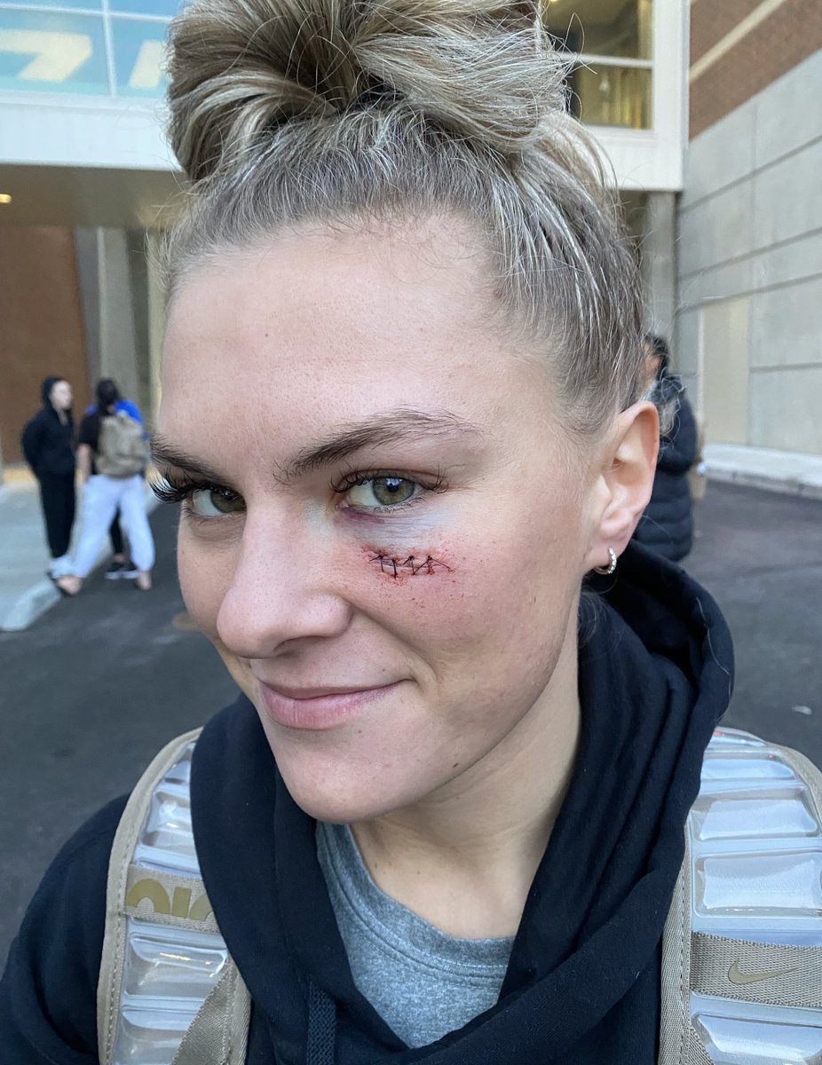 Paisley Harding (<a href="/paisleynikelle/">Paisley Harding</a>) is a baller. 

She played in the NCAA tournament with a broken thumb last year.

Then Saturday at Gonzaga she got stitched up during the game and led the Cougars w/ 22 points in a 15-point comeback win.

#BYUWBB 
<a href="/MarchMadnessWBB/">NCAA March Madness</a>