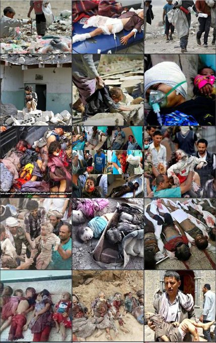 Haidarya22__'s tweet photo. هولاء الاطفال يتم قتلهم بدم بارد امام مراء ومسمع العالم المنافق ااا
#انقذوا_اطفال_اليمن https://t.co/PZ1jJM1wk9