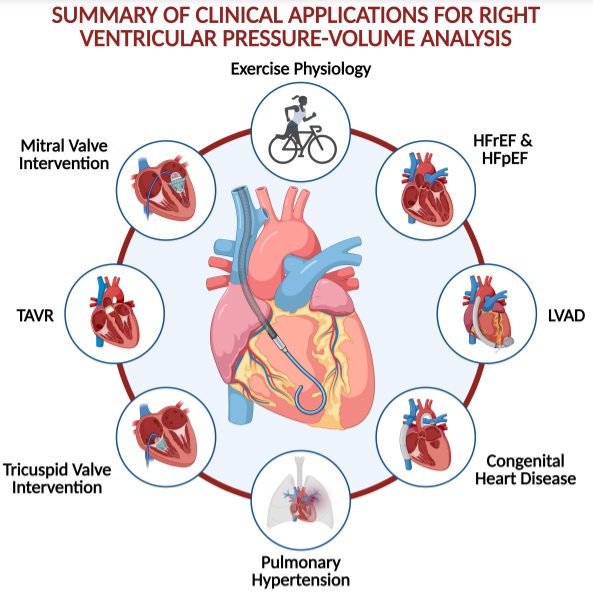 Circ: Heart Failure (@circhf) on Twitter photo #AdvancesInHF Review: Invasive Right Ventricular Pressure-Volume Analysis: Basic Principles, Clinical Applications & Practical Recommendations
ow.ly/a6SZ50HN1c1 #AHAJournals <a href="/BrenerMickey/">Mickey Brener MD MS</a> #AdvancesInHF Review: Invasive Right Ventricular Pressure-Volume Analysis: Basic Principles, Clinical Applications & Practical Recommendations
ow.ly/a6SZ50HN1c1 #AHAJournals <a href="/BrenerMickey/">Mickey Brener MD MS</a>