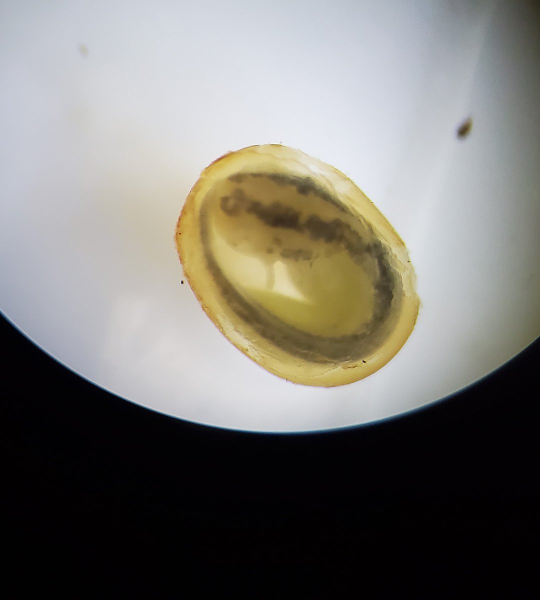 SeeMargaux's tweet photo. And by Day 18 you could actually see pigment under a microscope (the egg was found loose from the plant, so I took pics.  I did not disturb any on purpose!) https://t.co/XbIqd2fhM8