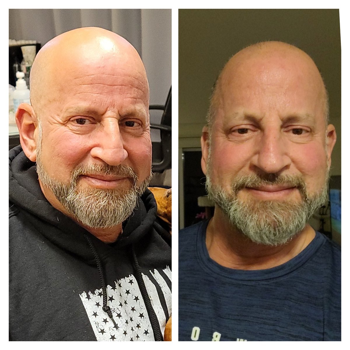 louiestravato's tweet photo. @SKINPros1 Dr. Antonio Cruz and staff are amazing. #botox https://t.co/H6kanjSJ1l