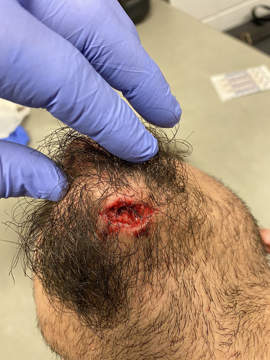 JTaylorATC's tweet photo. @injurypics https://t.co/b7t1AlFEj5