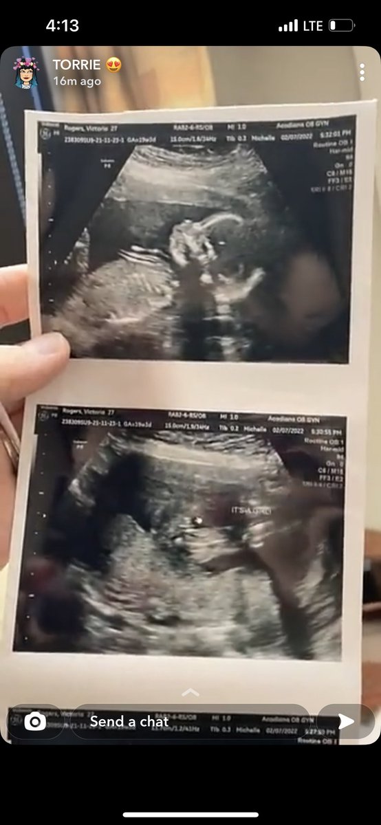 jsrogers09's tweet photo. Our baby girl is getting so big!! @torimfontenot https://t.co/KzXKo0NjBI