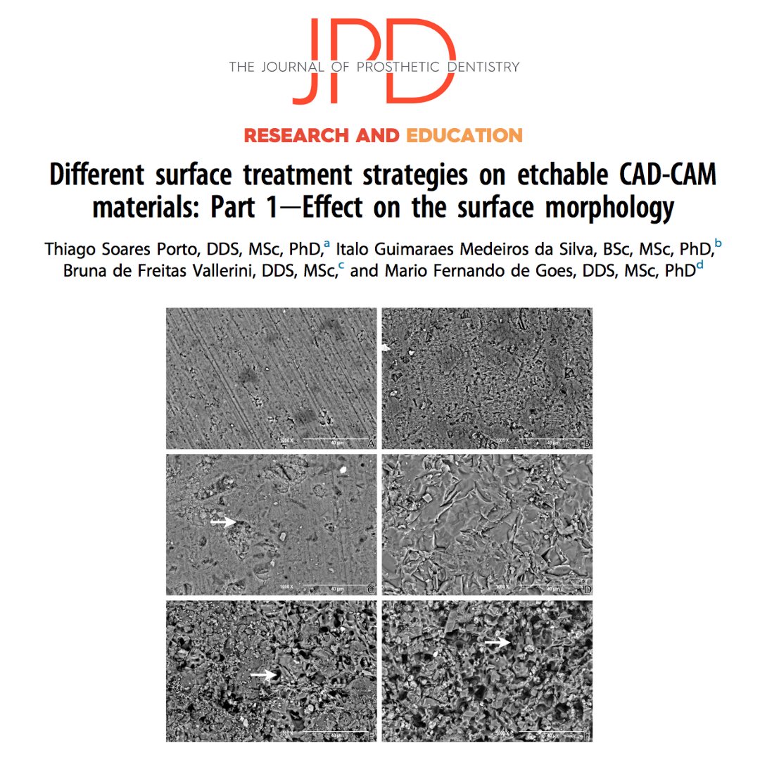 JPDentistry's tweet image. This 2-part study evaluates the effects of common surface treatments like #airabrasion and #acidetching that enhance dental procedures like #adhesivecementation on resin matrix ceramic composite #dentamaterials.

Learn more: thejpd.org/article/S0022-…
