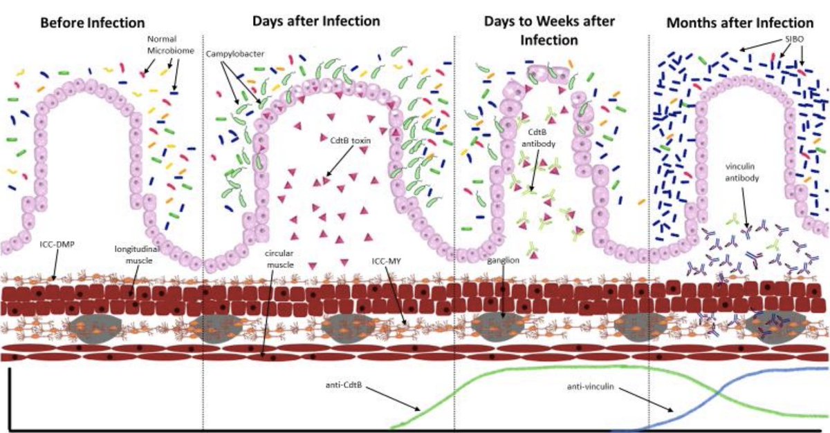 #IBS after infection with Campylobacter jejuni is common via autoimmunity, low-grade inflammation, alteration in motility, gut #microbiome
dysbiosis, and #SIBO.

#medtwitter #medicine #science #GITwitter #GI  #PIIBS #ID #IDTwitter 

academic.oup.com/femspd/advance…
