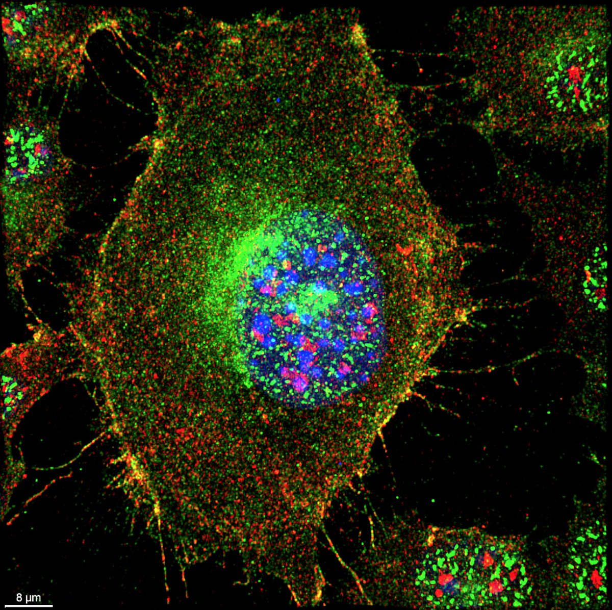 The BMOL-TAT cell line, generated by my supervisor Prof. @NinaTParker during her PhD, has to be one of the most beautiful cell lines I have ever seen! #cellbiology #microscopy #science #livertwitter #livercancer