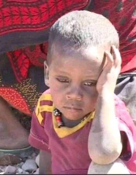 OusmanA62681426's tweet photo. #AfarUnderAttack! As lessons have been learned from previous brutal #TPLFAttack, GOE must show commitment to protect its citizens.
@PMEthiopia @FdreService Allow #NoMore violence and threats of attacks. #SaveAfar #AfarIsBleeding
@BilleneSeyoum @FdreService https://t.co/Il3DMXOYSq