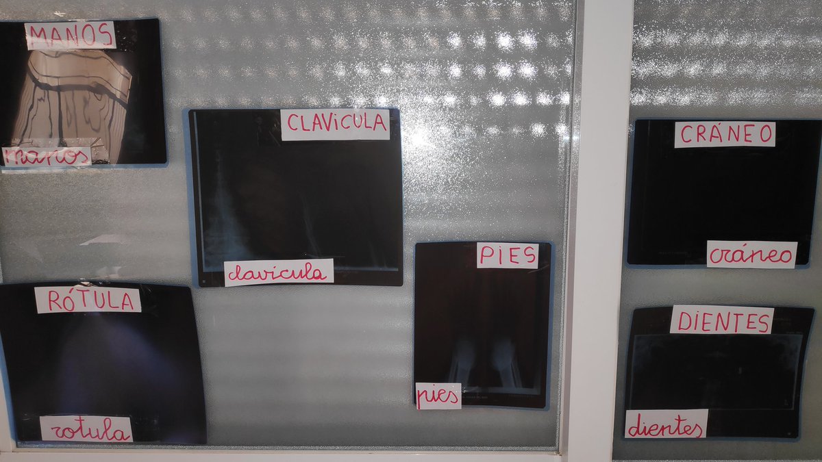 Hospitalillo preparado.
Hoy se abre la ventana al interior, nunca mejor dicho 🤪.