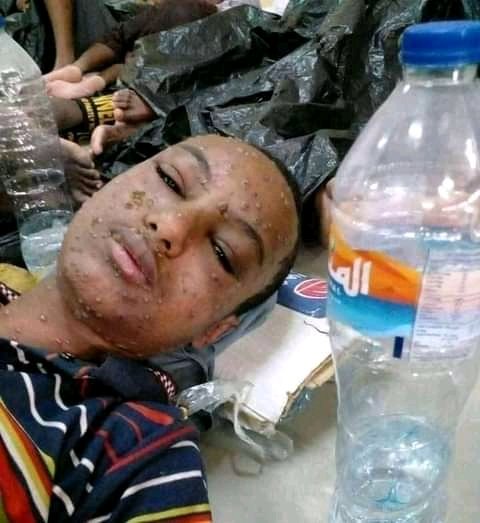 Teferi Regasa (@teferi_rj) on Twitter photo The government of Saudi Arabia is using lethal, highly infectious biological weapon that exposed Ethiopian citizens retained in Saudi's prison that exposed them to communicable disease!
Attention to Ethiopian citizens retained in Saudi Arabia!
<a href="/amnesty/">Amnesty International</a>
<a href="/UNmigration/">IOM - UN Migration πΊπ³</a>
<a href="/hrw/">Human Rights Watch</a> The government of Saudi Arabia is using lethal, highly infectious biological weapon that exposed Ethiopian citizens retained in Saudi's prison that exposed them to communicable disease!
Attention to Ethiopian citizens retained in Saudi Arabia!
<a href="/amnesty/">Amnesty International</a>
<a href="/UNmigration/">IOM - UN Migration πΊπ³</a>
<a href="/hrw/">Human Rights Watch</a>
