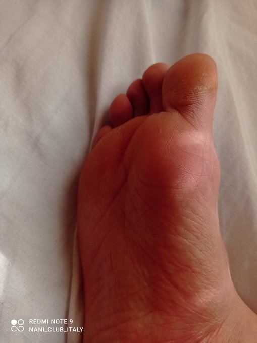 #feet #feetgay #gayitalia #lacetacea #sexy https://t.co/QWKI22xL6L<a href="/tag/feet"class="tags">#feet</a><a href="/tag/feetgay"class="tags">#feetgay</a><a href="/tag/gayitalia"class="tags">#gayitalia</a><a href="/tag/lacetacea"class="tags">#lacetacea</a><a href="/tag/sexy"class="tags">#sexy</a>