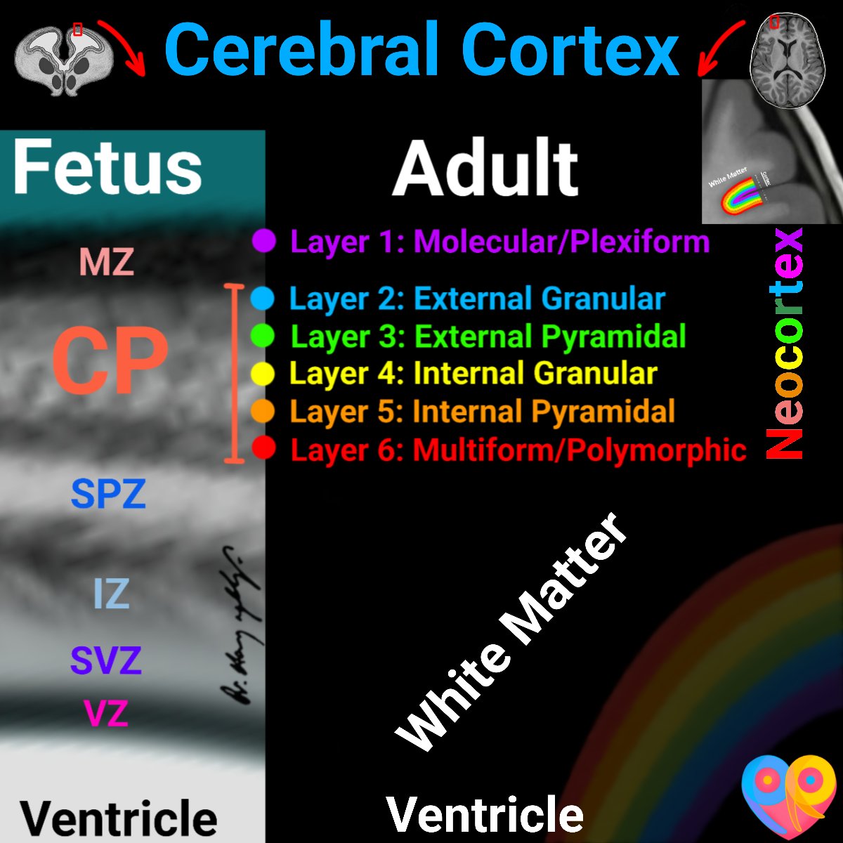 Neuronal Migration 🌈 

pediatrikradyoloji.com 

#MedEd #MedTwitter #RadTwitter #Radiology #PediatrikRadyoloji #radyoloji #pediatri #medschool #pedsrad #foamrad #foammed #pediatricradiology #pedrad #radres #PediNeurorad #NeuRad #radiologicalillustration #MedicalIllustration