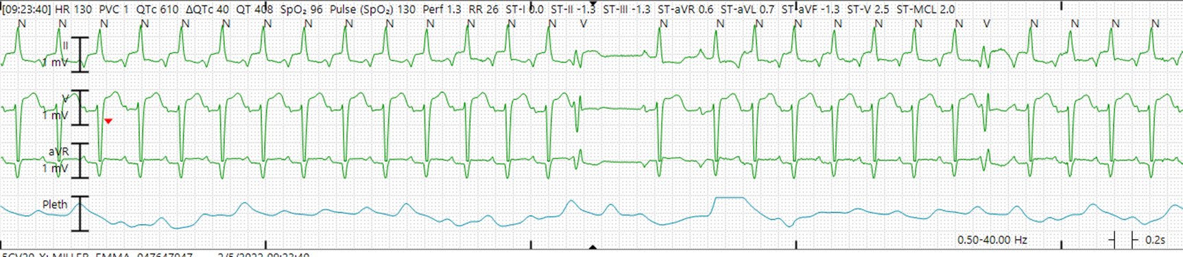 Gregory Michaud on Twitter: