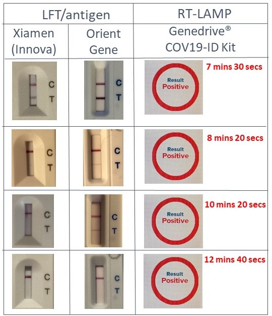 Benefit of high sensitivity of lab-based #covid19 molecular testing is well established. Its obvious on our rapid #POC test solution from #genedrive with positive results in 7.5 mins (stronger bands on #LFT) #GDR #moleculartesting #SARS_CoV_2 Variable LFT sensitivity is clear