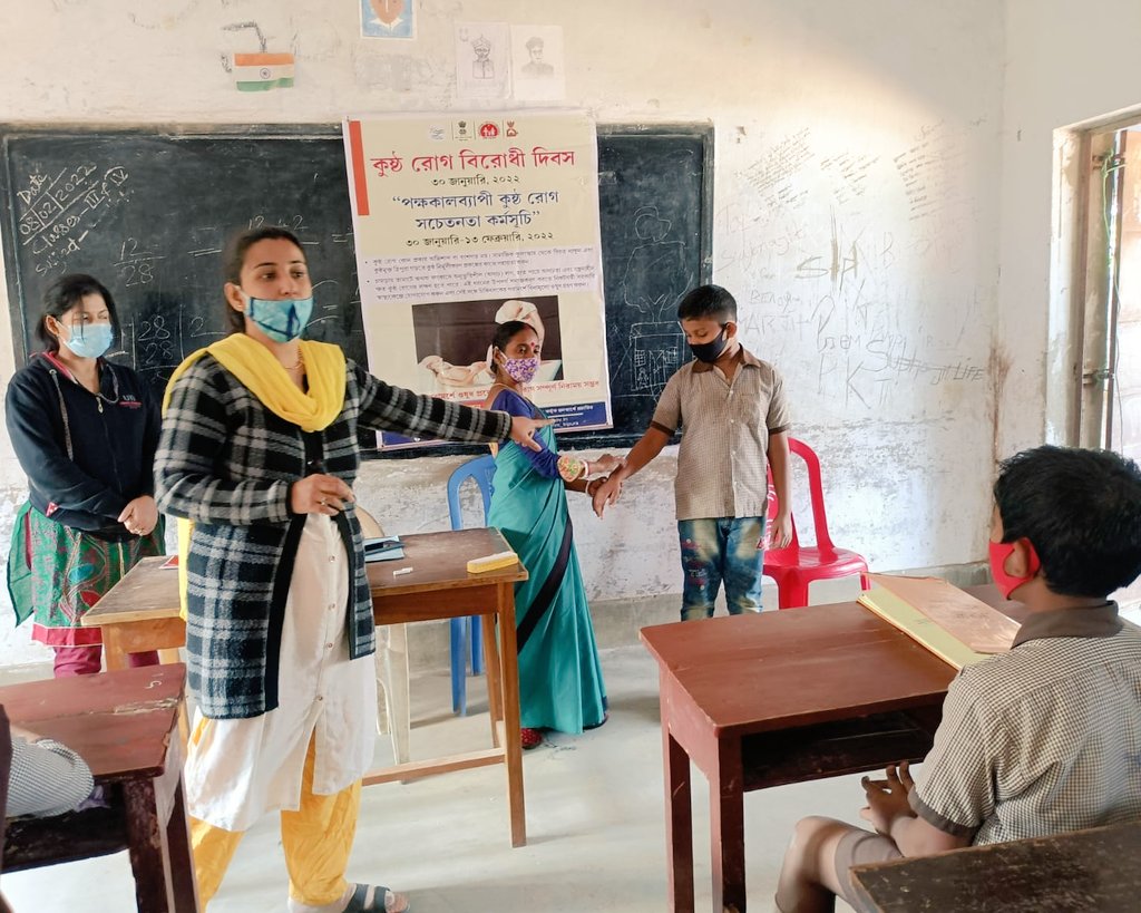 DrArpita16's tweet photo. School Level Awareness Generation on Leprosy at Bapuji Vidya Mandir School  as a part of observance of Sparsh Leprosy Awareness Campaign organized by Ashrampara UPHC on 8th February,2022..
#unityfordignity #SLAC https://t.co/1s6pWmlYZD