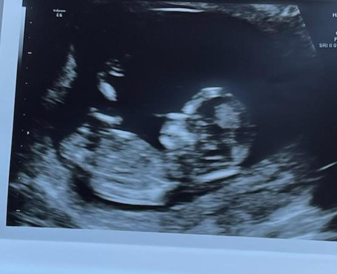 b4ifade's tweet photo. My baby's baby ❤💙 https://t.co/3ZjBME3b3w