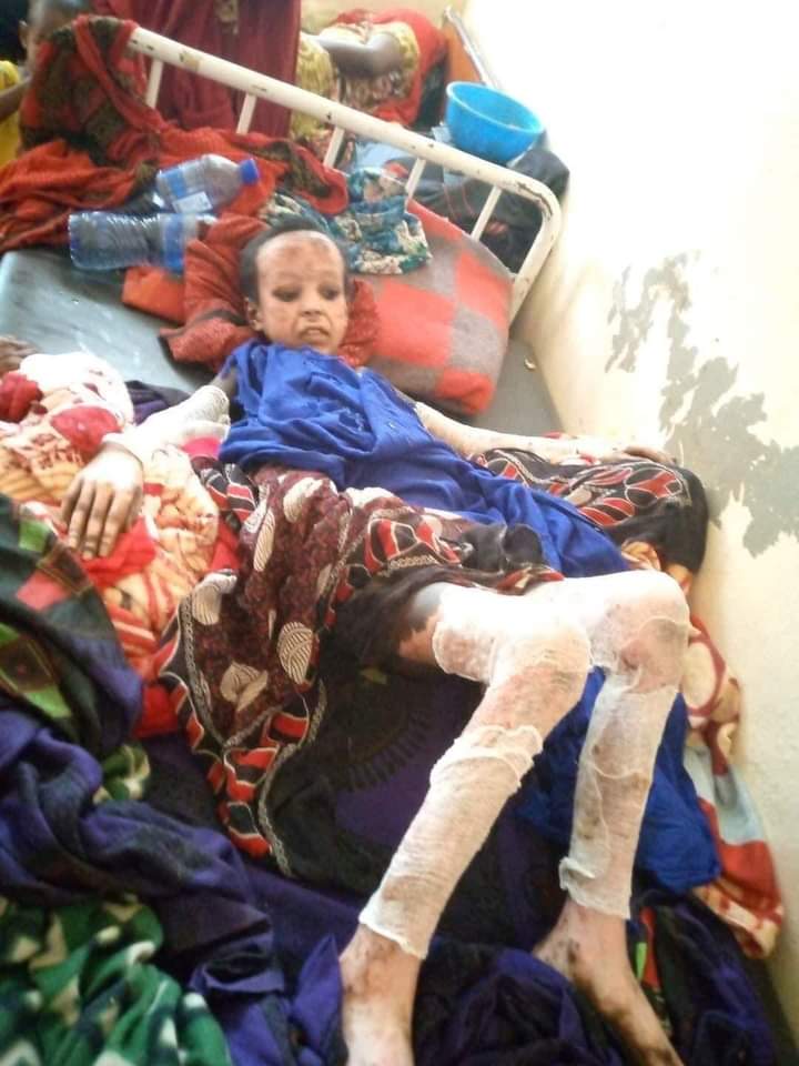 MikiShekspir's tweet photo. Afar people needs urgent humanitarian aid 😢
#AfarUnderAttack
#AfarGenocide 
#AfarUnderAttack https://t.co/YwLPBERzoW