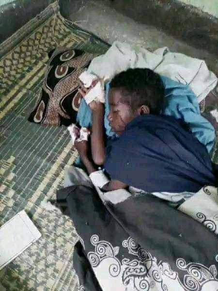 AhmedibnAfar776's tweet photo. Tigray Terrorists Kill Innocents in Heavy Fighting
This direct ethnic cleansing by the terrorist group #tplf 

ትግራይ አሻባሪ ቡድን በአፈር በከፈተው ውግያ የአፈር ንፁሃን በከበድ መስሪያ በመደበደብ ንፁሃንን ለሞት እየደረጉ ይገነሉ።

#AfarUnderAttack https://t.co/KokfHZh3dT
