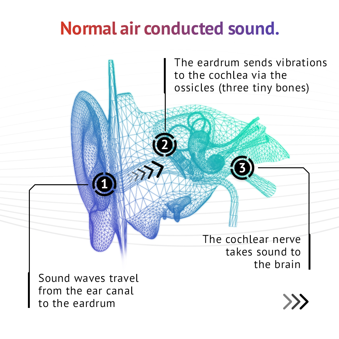 sentien_hq's tweet photo. Did you know you hear sound through two different ways? 🤯

#boneconduction #SentienAudio https://t.co/U1twnAGEQm