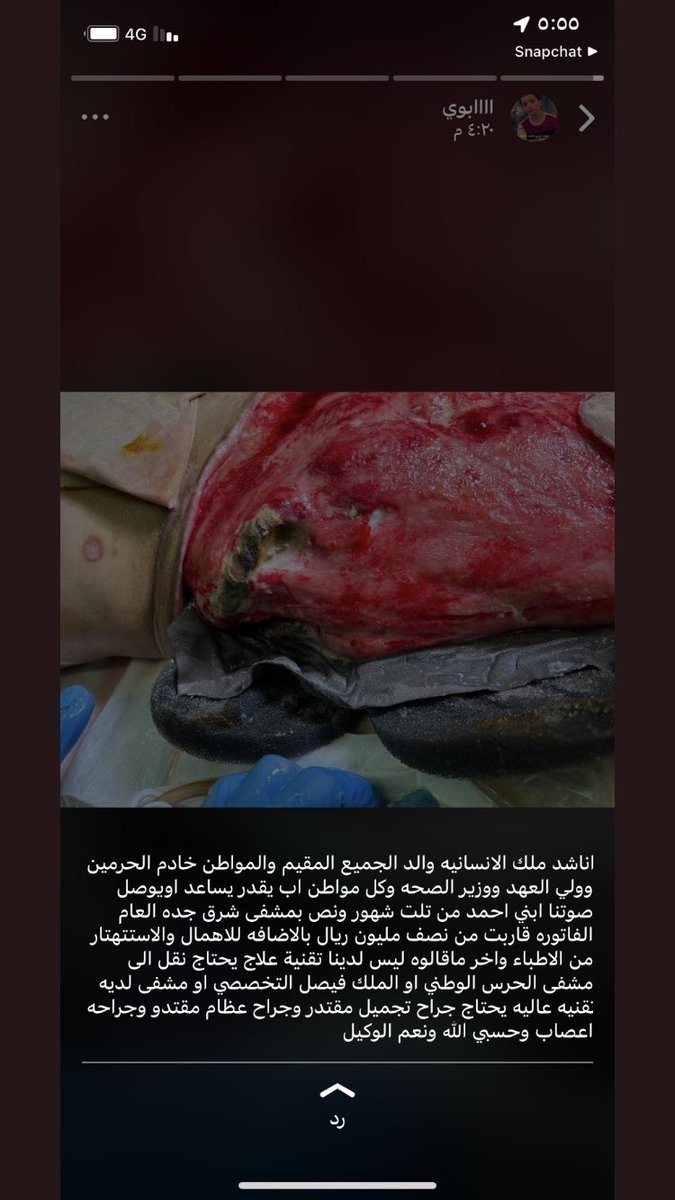 l_676_'s tweet photo. نناشد المملكة بالنظر الى حالة الطفل احمد     
#ساعدو_احمد
#احمد_يناجي_المملكة https://t.co/qggoT1hpCW