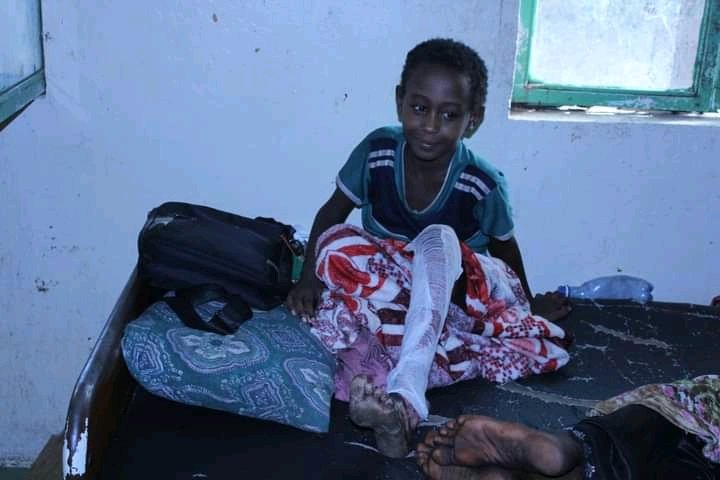 Alawikedir's tweet photo. Nura and Tahir (Brothers) survived the TPLF’s brutal attack by heavy gunshot but Their little body is burned. @hrw @UN_HRC @EthioHRC @UNOCHA @Atayeshe @AfarWatch @kontiem @dahilony @SuleimanAbdell7 @AbrarSuleiman https://t.co/QtRwAEWWPo