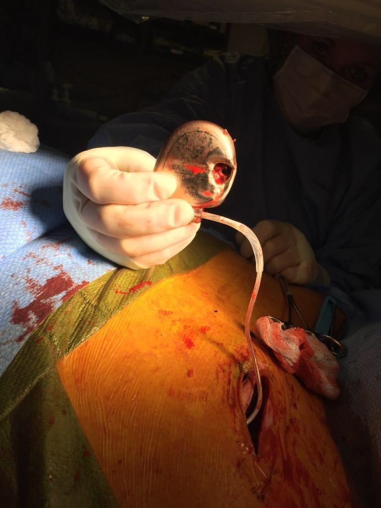 Prof Khaled Albouaini tweet media