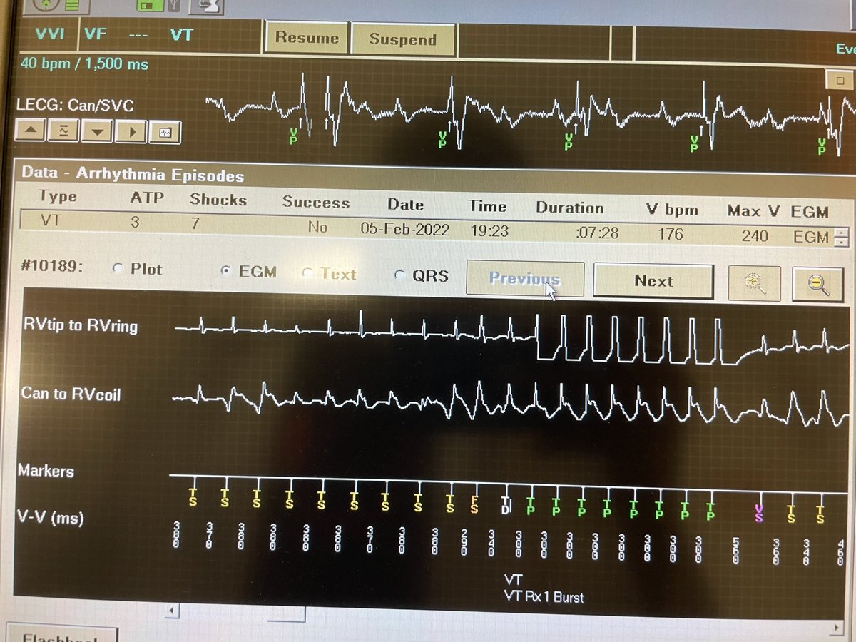 LordHFerreira's tweet photo. 27 therapies 😰😰 >>> exhausted therapies! Luckily the patient only felt 6. #EPeeps #YoungEP #FellowFirst https://t.co/nyuxKsqpOM