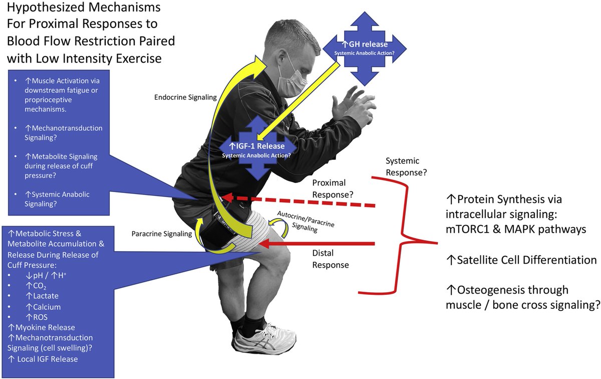Arthroscopy Journal (@arthroscopyj) on Twitter photo The use of blood flow restriction (BFR) within rehabilitation has been increasing. Benefits have been found in musculature proximal to the occlusive stimulus. #physicaltherapy <a href="/chedtDPT/">Corbin Hedt</a> <a href="/JoshuaHarrisMD/">Joshua Harris, MD</a> …pysportsmedicineandrehabilitation.org/article/S2666-… The use of blood flow restriction (BFR) within rehabilitation has been increasing. Benefits have been found in musculature proximal to the occlusive stimulus. #physicaltherapy <a href="/chedtDPT/">Corbin Hedt</a> <a href="/JoshuaHarrisMD/">Joshua Harris, MD</a> …pysportsmedicineandrehabilitation.org/article/S2666-…