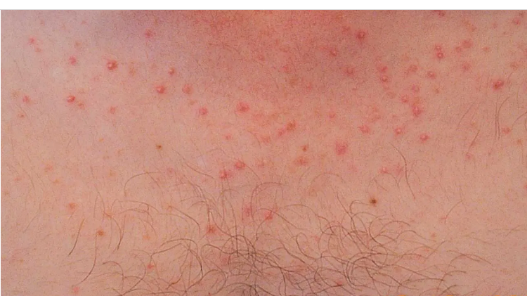 WuidQ: Washington University ID Questions tweet media