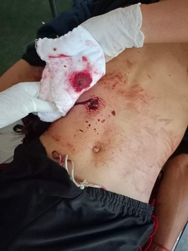 spring21MM's tweet photo. Tw\\Blood
Military Terrorists Randomly Fired Gunshots during the shootout with KNLA in #Jopinseik village,#Hpa_an Tsp on Feb 7 morning—Seriously injuring a civilian on the motorcycle. Currently, The man was rescued and treated by KNLA.
#2022Feb9Coup
#WhatsHappeningInMyanmar https://t.co/nU3LHhF6g7