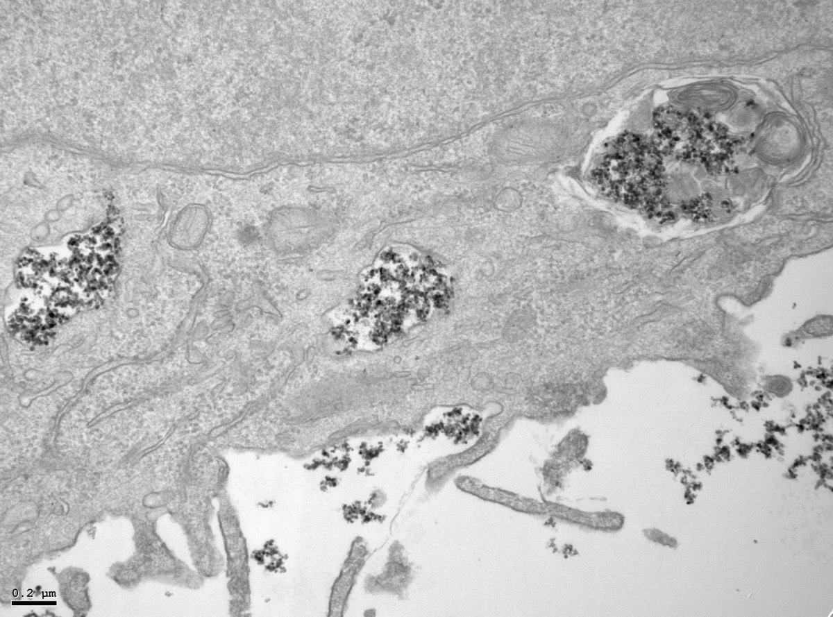 Áreas Científico-Técnicas VAACT-CSIC (@csic_vaact) on Twitter photo Científicos de <a href="/Nanomed_CSIC/">NanomedCSIC</a> publican un artículo sobre la degradación de #nanopartículas de óxido de hierro en el interior de las células, estudio clave para entender la liberación de #fármacos de forma localizada.
👉csic.es/es/actualidad-…
#Cáncer #CSIChubs #ConexionesCSIC Científicos de <a href="/Nanomed_CSIC/">NanomedCSIC</a> publican un artículo sobre la degradación de #nanopartículas de óxido de hierro en el interior de las células, estudio clave para entender la liberación de #fármacos de forma localizada.
👉csic.es/es/actualidad-…
#Cáncer #CSIChubs #ConexionesCSIC
