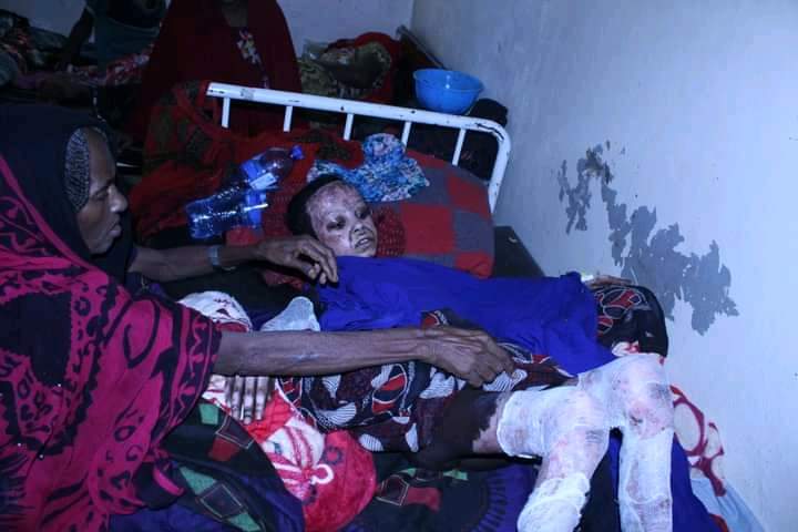 YohWalker's tweet photo. The government hasn't said anything with the massacre of Afar children and women.
#StopSilencing
#AfarUnderAttack
#AfarGenocide
#Ethiopia https://t.co/UZtAIiuHts