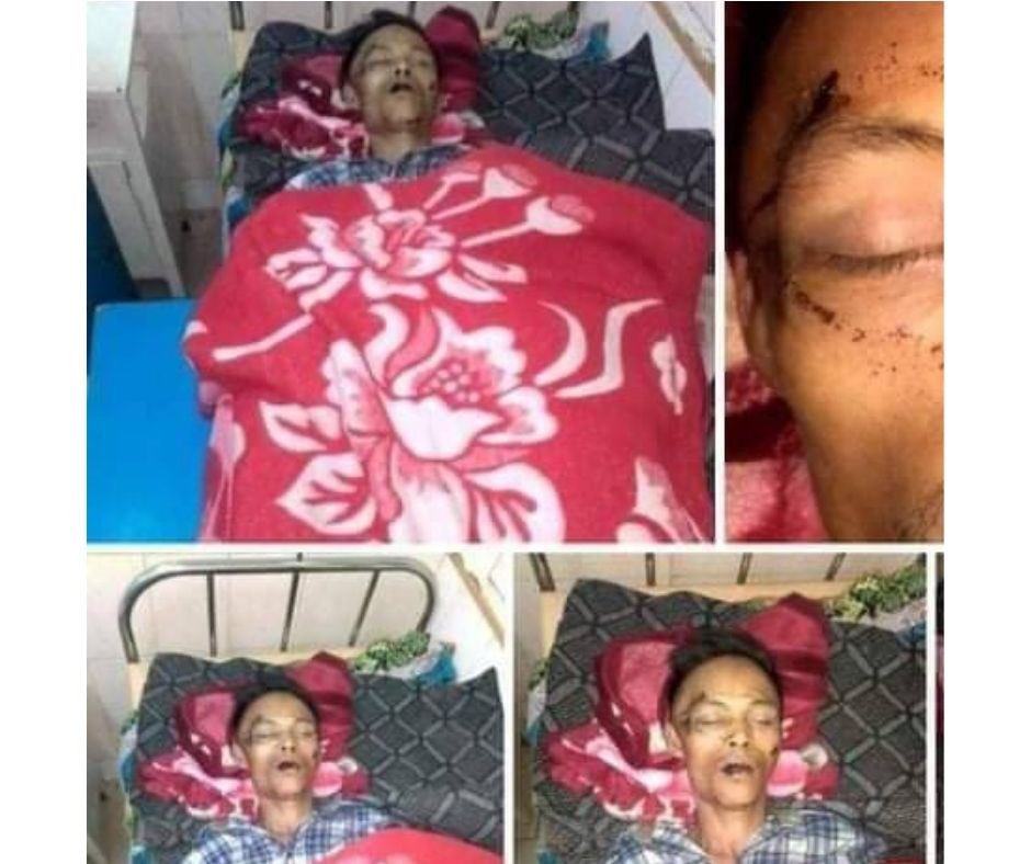WaiWarr1's tweet photo. A refugee man who displaced to Kyaukme tsp, northern Shan state was abducted by SAC terrorists on Feb 2, and tortured him until his death. The terrorists also looted his properties. #2022Feb9Coup #WhatsHappeningInMyanmar https://t.co/rbTKaJS8gC